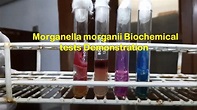 Morganella morganii Biochemical tests Demonstration - YouTube