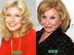 Michael Learned Plastic Surgery Before and After Picture | Plastic ...