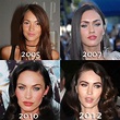 Megan Fox Plastic Surgery - She May Not Be A Natural Beauty Afterall