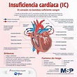 Insuficiencia cardíaca - Infografía