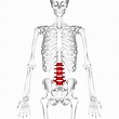 lumbar-spinal-stenosis - Bye Bye Lower Back Pain