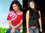 Ayesha Takia Plastic Surgery Before and After Breast Implant Photos ...