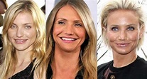 Cameron Diaz Plastic Surgery Before and After Pictures 2024