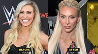 Charlotte Flair Plastic Surgery 2023. Dental, Breast Implants, And New ...