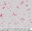 √100以上 e coli morphology gram stain 283207-E.coli gram stain morphology ...