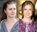 Amy Adams | Natural Beauty: Stars Without Makeup | Us Weekly