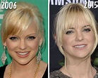 Anna Faris Plastic Surgery: See How the Actress Has Transformed