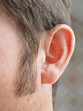 Sideburn Restoration: Everything You Need To Know