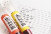 Your blood work, on the edge of normal - Harvard Health