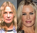 Daryl Hannah before and after plastic surgery 02 – Celebrity plastic ...