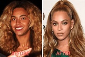 Celebrity before and after plastic surgery: shock transformations
