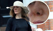 Tara Palmer-Tomkinson shows off her new nose for first time after ...