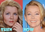 Melody Thomas Scott Plastic Surgery Before and After Facelift - Lovely ...