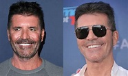 ¿Qué pasó con los dientes de Simon Cowell? Antes y después explicado ...