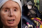 Fresh setback for Travis the chimp attack victim after her body rejects ...