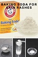 How to use Baking Soda for Rashes