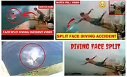 Split face diving accident full video Reddit