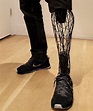 Prosthetic legs can how be made from 3D-printed titanium | Prosthetic ...