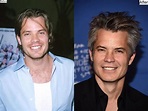 Timothy Olyphant Hair Transplant and Plastic Surgery