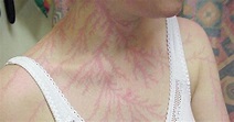 TYWKIWDBI ("Tai-Wiki-Widbee"): A Lichtenberg figure