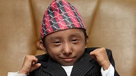 World's shortest man who could walk dies aged 27 | World News | Sky News