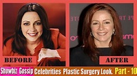 101 Celebrities Plastic Surgery Before and After Look. (91-101) | Part ...