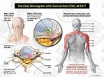 Coluna Cervical C1 C2 C3 C4 C5 C6 C7 - EducaBrilha