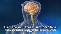 Esclerose Amiotrófica Lateral; Doença de Lou Gehrig; Doença do Neurônio ...