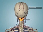 Atlas axis spine syndrome - Dr. Nimet KAŞKARLI