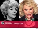 Joan Rivers Before Plastic Surgery - Inspiring Your Life