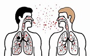 Todo lo que tenés que saber sobre la Tuberculosis | Crónica | Firme ...