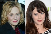 Zooey Deschanel Plastic Surgery: Botox, Nose Job, Before and After