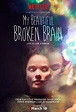 My Beautiful Broken Brain Reveals the Aftermath of a Brain Hemorrhage ...