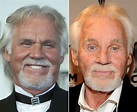 Kenny Rogers plastic surgery giving him a youthful look