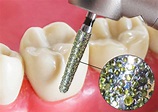 Dental Diamond Bur Clinical Uses - Strauss Surgical Burs - Strauss Diamond