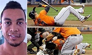 Baseball player Giancarlo Stanton releases first photos of injuries ...