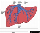 Figure 9.63 from The Hepatic Artery, Portal Venous System and Portal ...