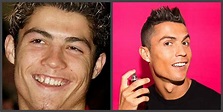 Cristiano Ronaldo - teeth before and after, a selection of photos
