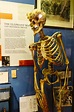 Replica of the skeleton of Joseph Merrick on display in the Royal ...