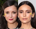 Nina Dobrev Plastic Surgery Comparison Photos
