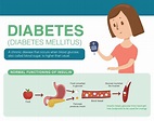 Diabetes Mellitus: Types, Risk, Causes And Its Treatment