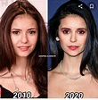 Nina Dobrev Plastic Surgery Before And After Nose Job Photos