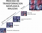 Cancer cérvicouterino - Cancer y Oncología Medina
