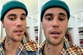 Justin Bieber, la malattia e il viso paralizzato per metà: «Ho la ...
