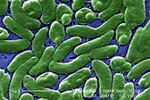 Imagen gratis: células de agrupación, Vibrio vulnificus, bacterias ...