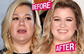 Kelly Clarkson Loses Weight Before And After Pics