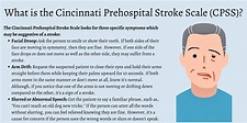 What is the Cincinnati Prehospital Stroke Scale (CPSS)?