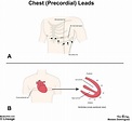 Electrocardiogram (ECG) | USMLE Strike