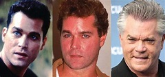 Ray Liotta Plastic Surgery Before and After Pictures 2024