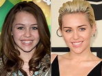 Miley Cyrus plastic surgery, Before and After | Celebrity Plastic Surgery